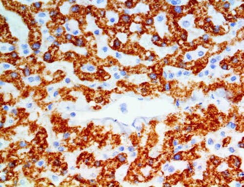 IHC of IMP-3 on a FFPE Liver Tissue